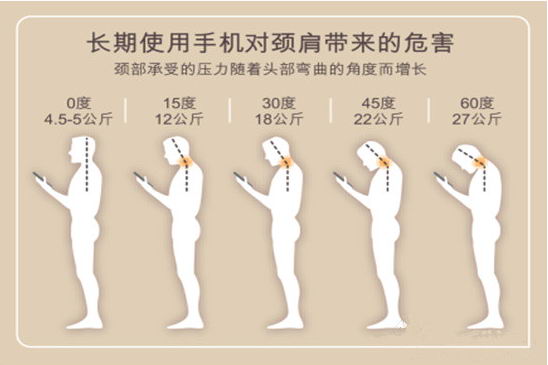 颈舒颗粒：手机低头族 你的颈椎还好吗？