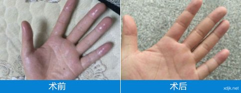 ֺóETS΢㣡